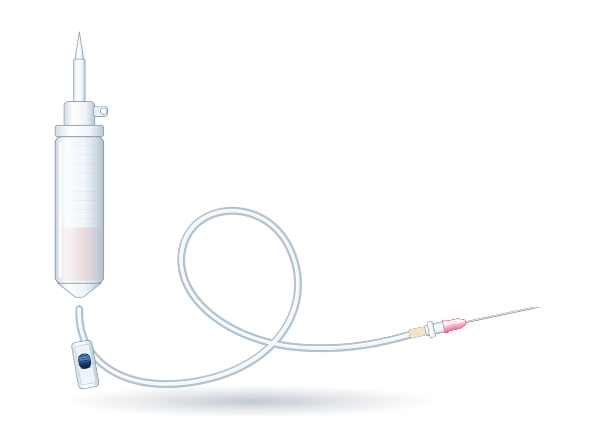 Illustration of the Blood Transfusion Set (BT Set, Vented)